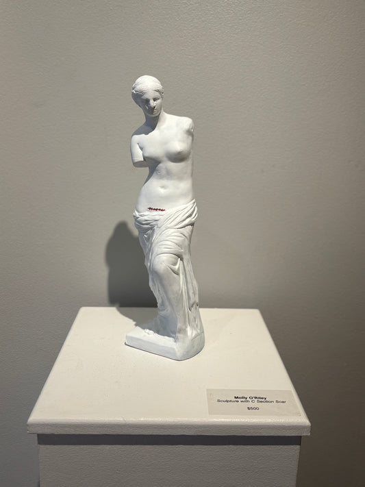Sculpture with C Section Scar